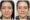 7 benefits of Exilis